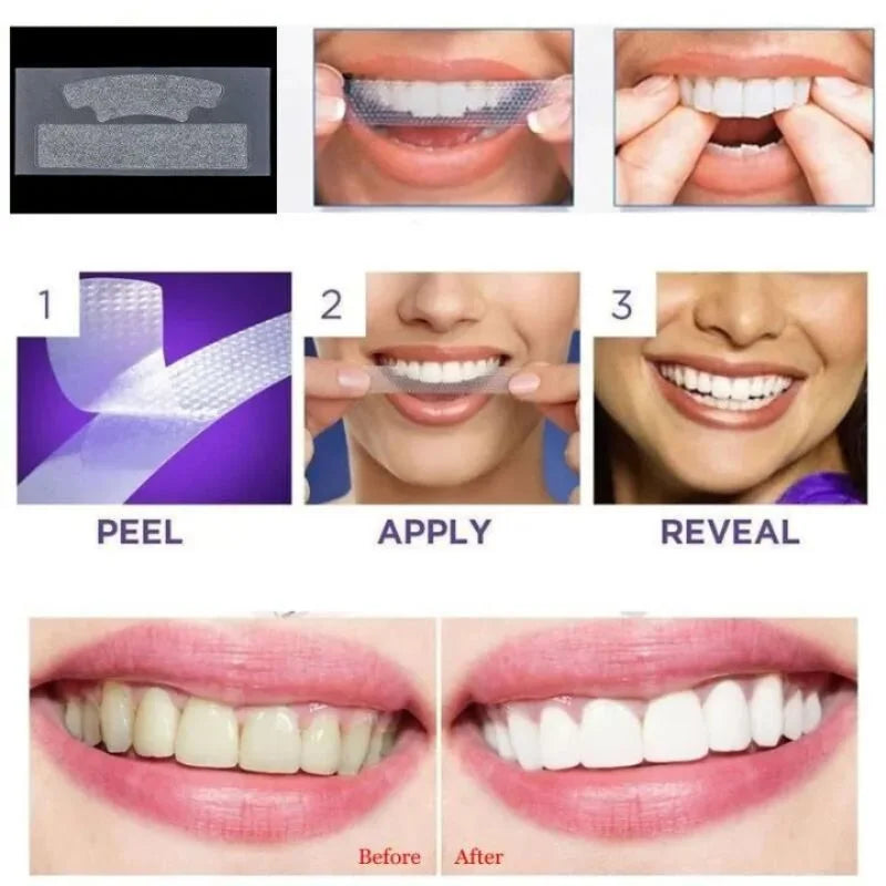 Gegemoon 9D Teeth Whitening Strips | Professional Teeth Whitening Kit | Enamel Safe Whitening Strips | Deep Stain Removal | Mint Flavor | 7 Pairs